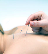 Acme Acupuncture and Chinese Herbs Clinic - your dependable acupuncturist and herbalist. 